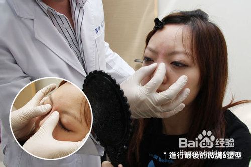 玻尿酸隆鼻常见的六大疑问?