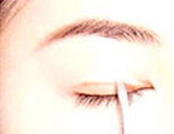 怎样快速贴好双眼皮