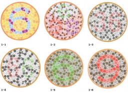 华锐视光视觉检查