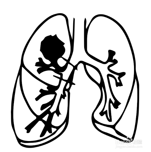 新冠肺炎简笔画