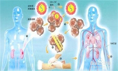 基因疗法和活细胞疗法