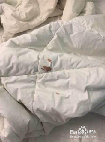 如何清理床单上的血迹