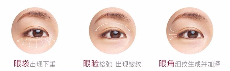 什么牌子的眼霜好 眼霜排行榜8强产品分享与您