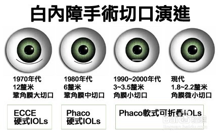 白内障患者术后应该怎么样护理