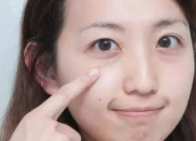 如何去除眼袋小窍门