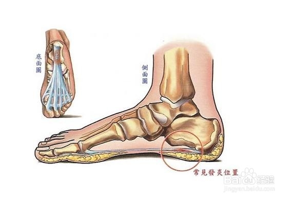 预防长鸡眼的方法有哪些_百度经验
