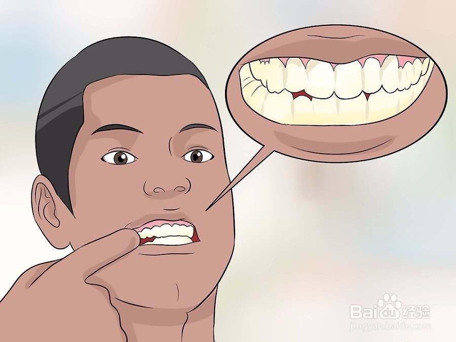 如何修复牙釉质