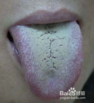 原来身体也有密码：[3]舌头告诉你的6个密码