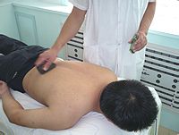 小儿外感发热中医外治法介绍