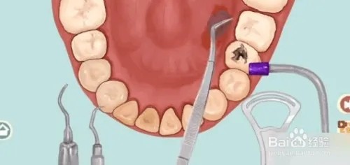 小小收纳唇红齿白通关攻略