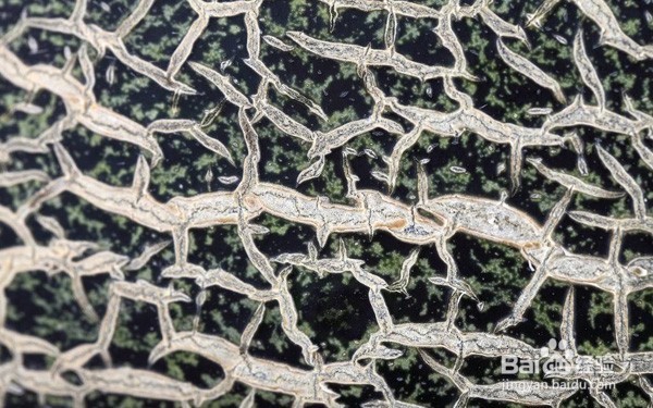 扁平苔藓症状哪些较常见