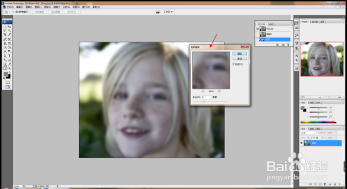 PS美化人物图像去除雀斑