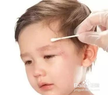 婴儿从床上掉下来怎么办