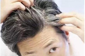 怎样根据头部判断身体所需补充的营养