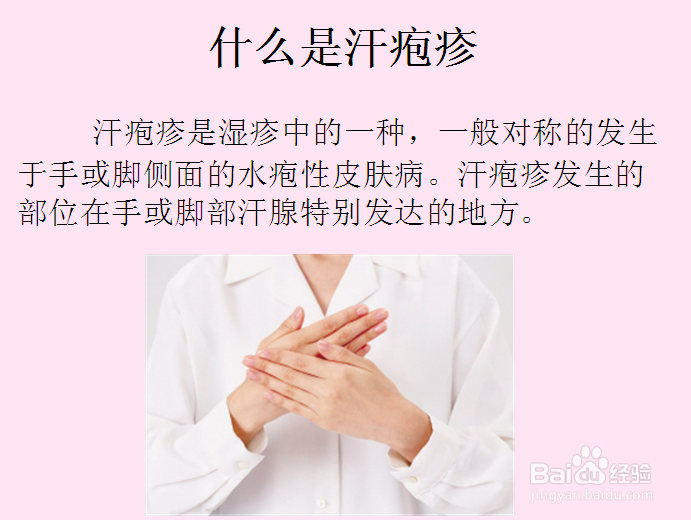 汗疱疹怎么办【精华版】