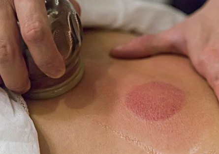 请问刮痧与走罐的主要区别.