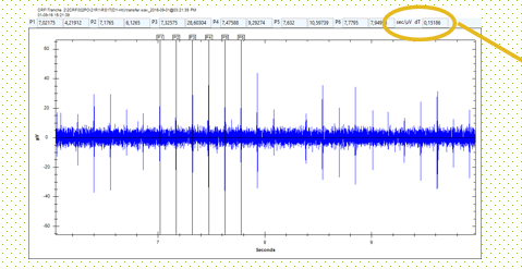 最新超声波检漏仪SDT340状态指数的作用(2)