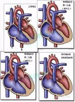 如何预防胎儿先天性畸形