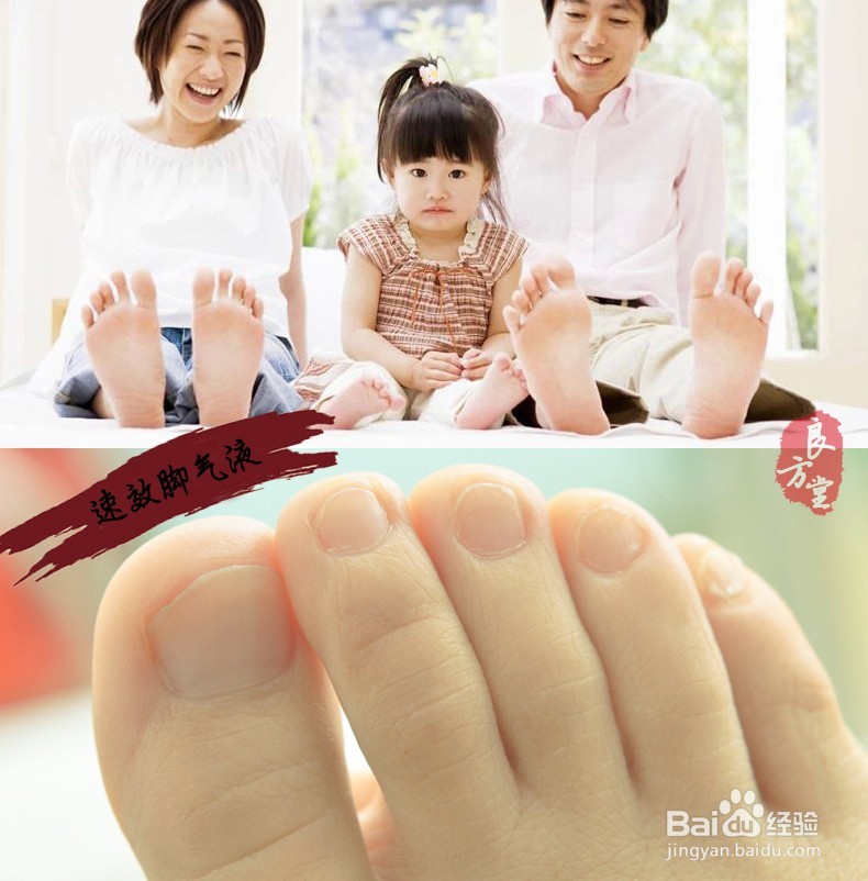 糜烂型脚气用什么药