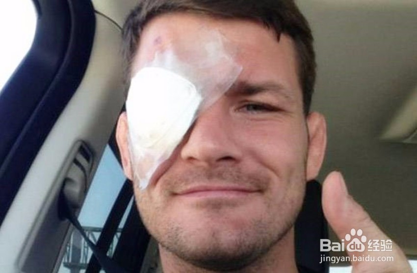 如何预防视网膜脱落