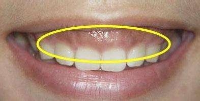 怎样刷牙才是最正确的？