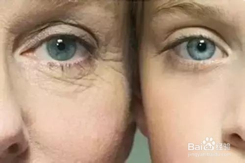 毛孔粗大怎么办？