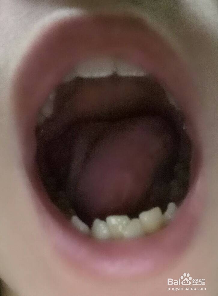 小儿牙齿不整齐的原因