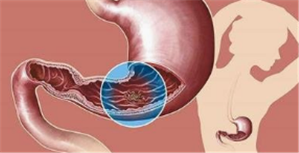 哪些是不宜饮茶者