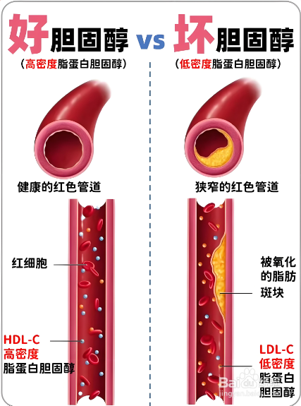 如何通过饮食自然降低胆固醇?