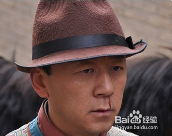 流鼻血了怎么办？