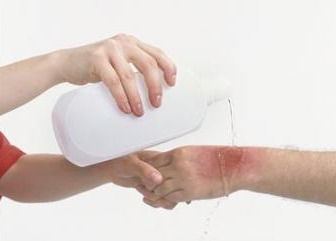 烫伤如何自行处理