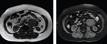 MRI的检查方法有哪些