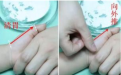 鹅口疮的推拿调理手法,适合婴幼儿