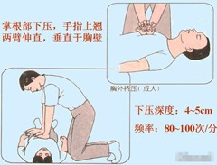 呼吸心跳停止如何进行心肺复苏术