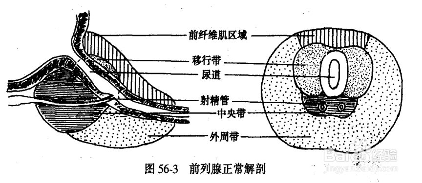 良性前列腺增生?