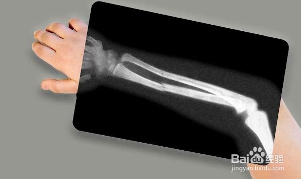 影响男性的最常见类型的癌症