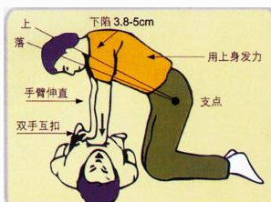 干性溺水如何急救