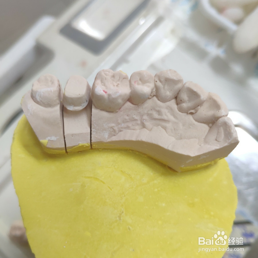 如何保护好我们的牙齿？