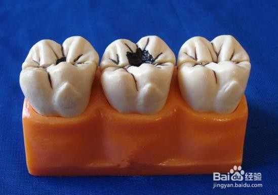 牙松动疼痛怎么办