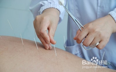 【户外知识】户外运动后如何缓解肌肉疼痛