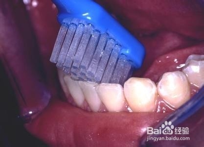 这些坏习惯最伤牙齿,请爱护自己的牙齿