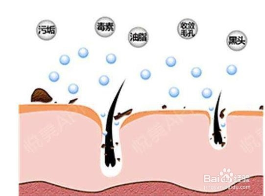 油性皮肤毛孔粗大怎么办