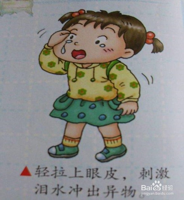 旅行出游时眼睛迷眼了如何去除眼内异物