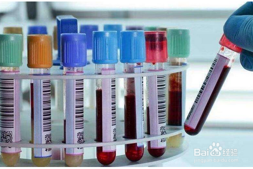 孕期哪些产检需要注意？