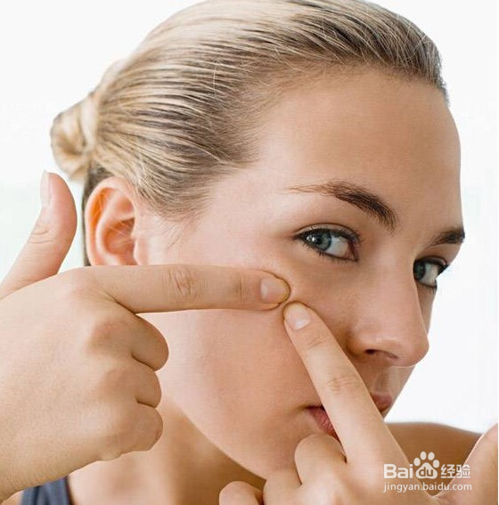 发痤疮了怎么办？