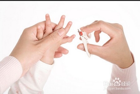 奶癣——婴儿湿疹的防治措施