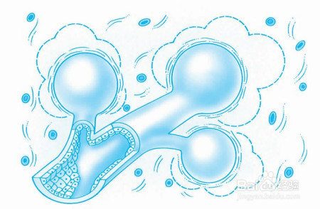 你对炎症有哪些常见误解？