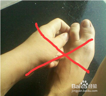 夏天得了脚气怎么办