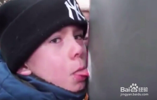 舌头冻在柱子上怎么办