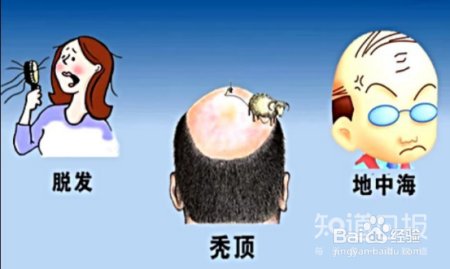 头发脱至成追忆,纵是植发已惘然